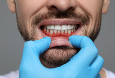 Periodontal Therapy