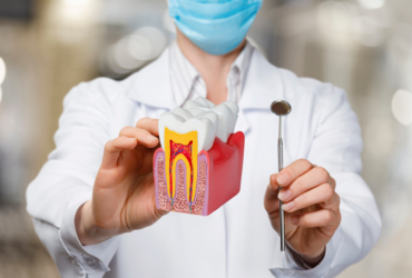 Root Canal Treatment