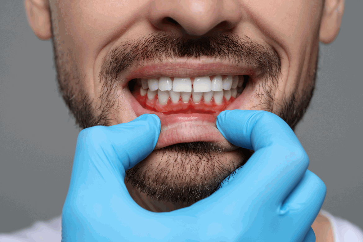 Periodontal Therapy