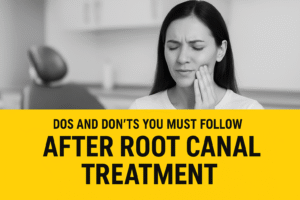 Dos and Don’ts You Must Follow After Root Canal Treatment