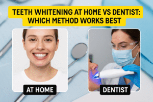 Teeth Whitening at Home vs Dentist: Which Method Works Best