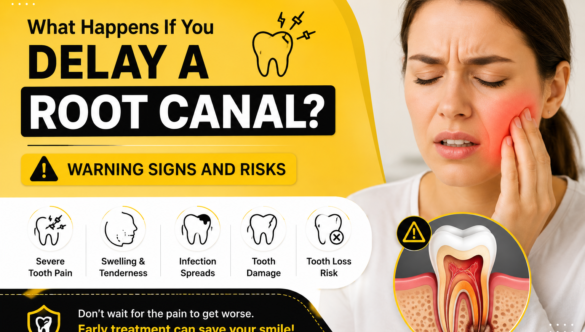 What Happens If You Delay a Root Canal? Warning Signs and Risks